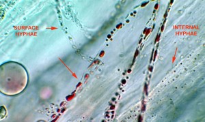 Lipid bodies of fungi